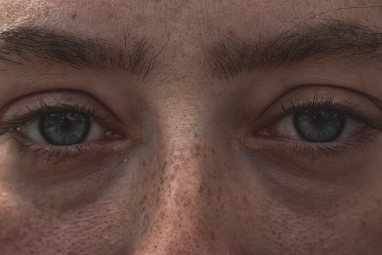 Close up of woman's blue eyes and freckles on her face
